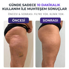 VELNORA™ Şarjlı Roller Masaj Aleti | Selülit Karşıtı, Vücut Sıkılaştırıcı ve Şekillendirici