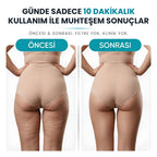VELNORA™ Elektrikli Döner Masaj Aleti - Selülit Karşıtı, Vücut Sıkılaştırıcı ve Şekillendirici