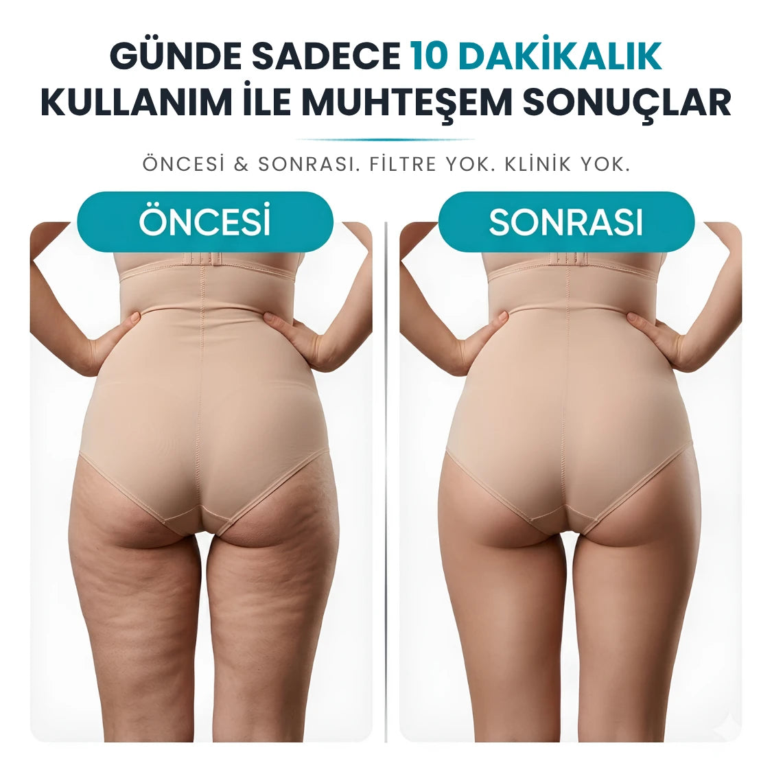 VELNORA™ Elektrikli Döner Masaj Aleti - Selülit Karşıtı, Vücut Sıkılaştırıcı ve Şekillendirici