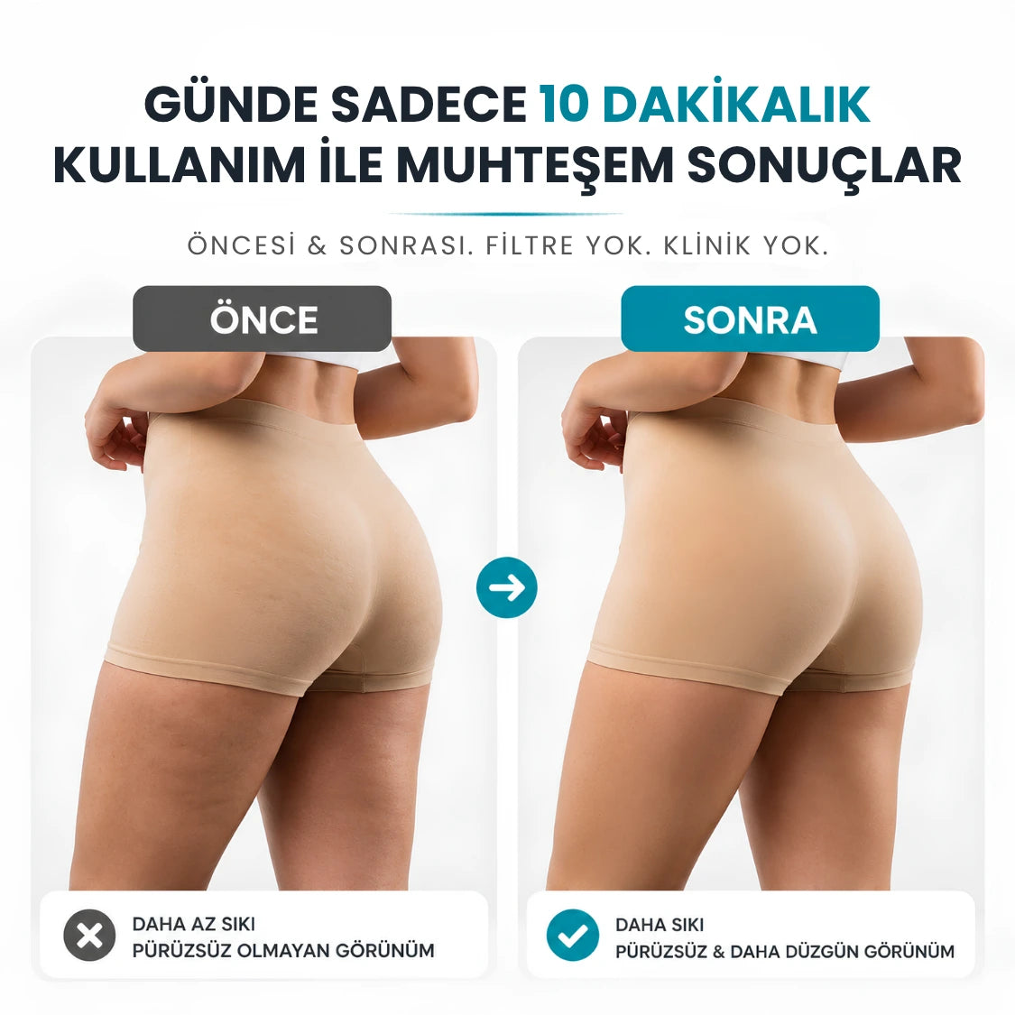 VELNORA™ Elektrikli Döner Masaj Aleti - Selülit Karşıtı, Vücut Sıkılaştırıcı ve Şekillendirici
